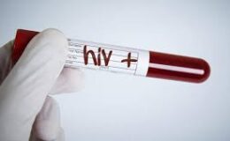Beş örgüt HIV konusunda ortak açıklama yayımladı