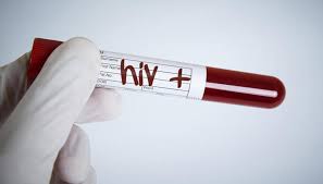 Beş örgüt HIV konusunda ortak açıklama yayımladı
