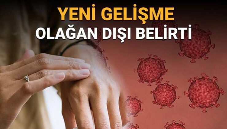 Dünyayı sarsan HMPV’de yeni gelişme: Olağan dışı belirti tespit edildi