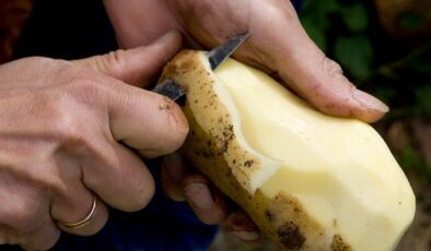 20 yıldır sadece patates yiyor: Nadir görülen yemek fobisi hayatını kabusa çevirdi