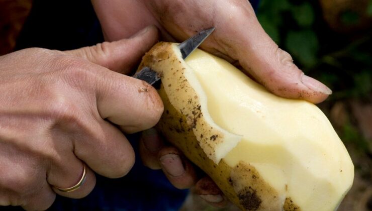 20 yıldır sadece patates yiyor: Nadir görülen yemek fobisi hayatını kabusa çevirdi