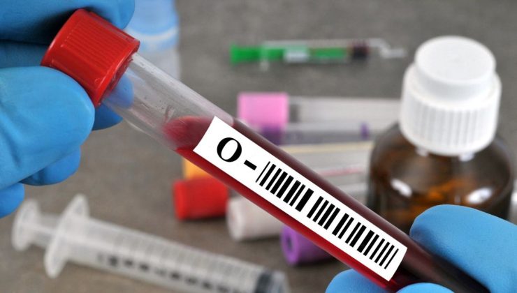 0, A, B, AB kan grubu nasıl beslenmeli? Bu yiyeceklerden uzak durun