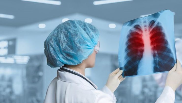 Hemen hastaneye gitmeniz gerektiğini gösteren 8 zatürre belirtisi