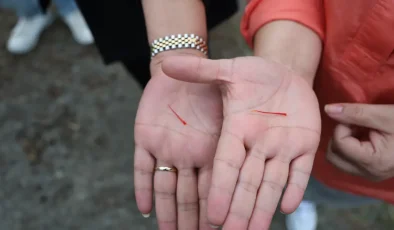 Meme kanseri tedavisinde etkili olduğu biliniyor, gramı 600 lira