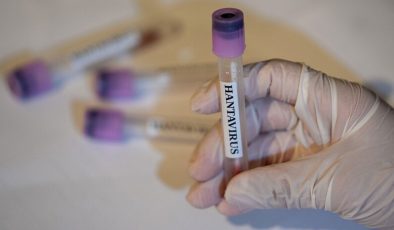 Hantavirüs enfeksiyonu erken dönemde grip ile karıştırılabiliyor