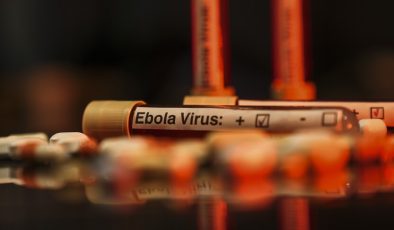 ABD’de 2026 FIFA Dünya Kupası Öncesi Havalimanlarında Ebola Tarama Merkezleri Kurulacak