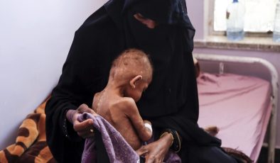 18 milyondan fazla kişi şiddetli açlıkla karşı karşıya
