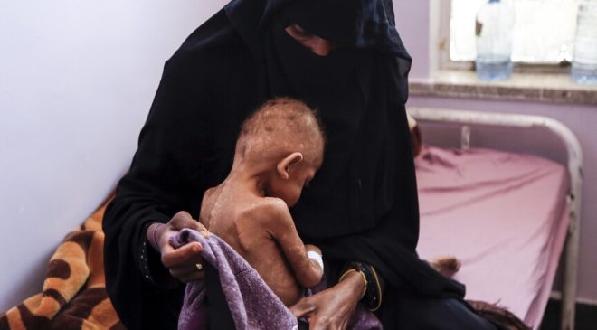 18 milyondan fazla kişi şiddetli açlıkla karşı karşıya