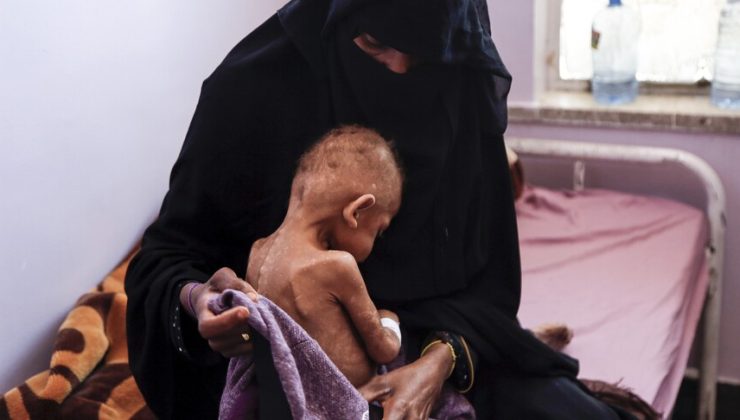 18 milyondan fazla kişi şiddetli açlıkla karşı karşıya