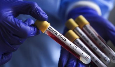 Kongo Demokratik Cumhuriyeti’ndeki Ebola Salgınında Bilanço AğırlaşıyorVaka Sayısı 1155’e Ulaştı