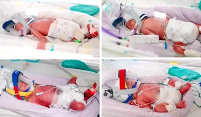 Doğal yolla tek yumurta dördüzü dünyaya geldi