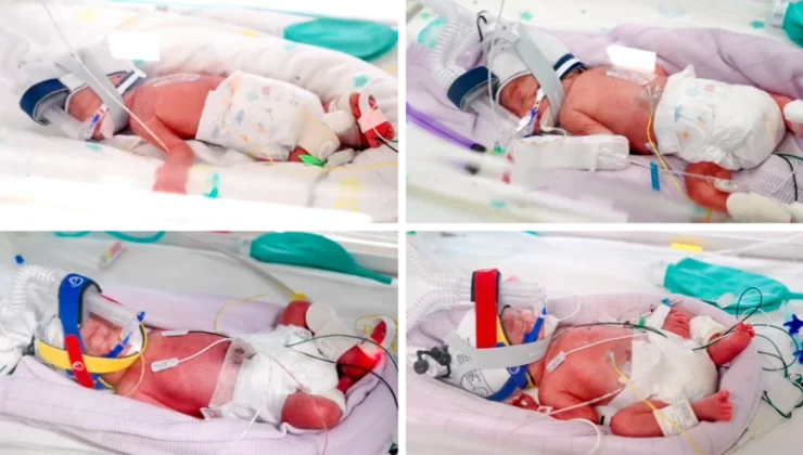 Doğal yolla tek yumurta dördüzü dünyaya geldi